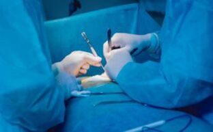 Ligamentotomie - eine Operation zur Verlängerung des Penis
